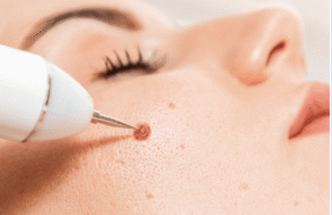 dermatologist dubai