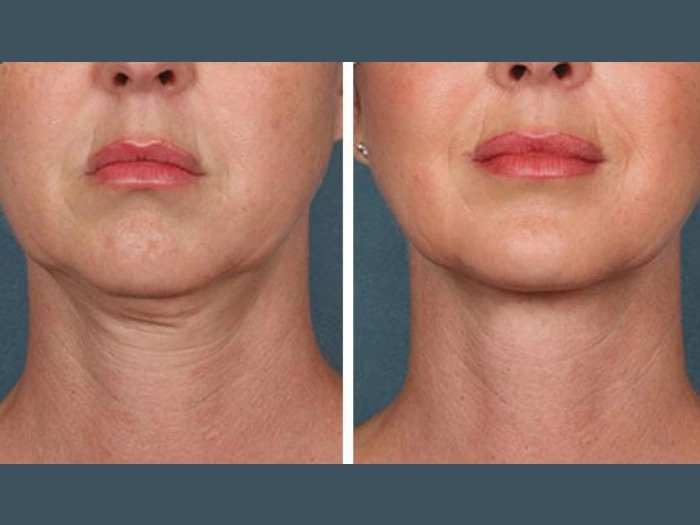 Best Doctors in Dubai for PRP Treatment: Regain Confidence