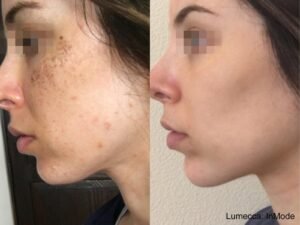 dermatologist dubai