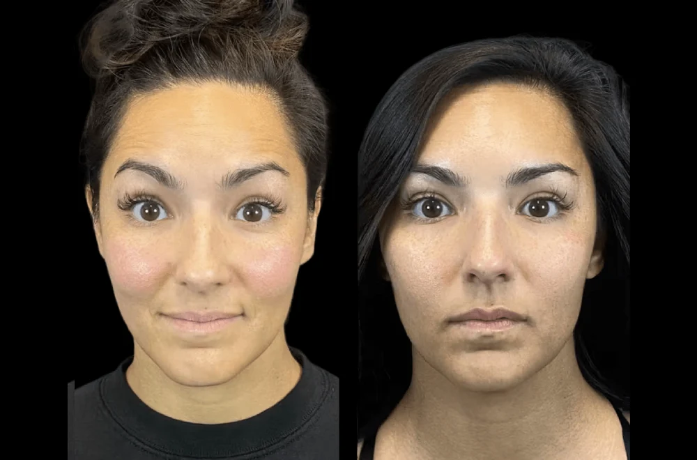 The Best Aesthetic Clinic in Dubai Shares Their Secret to Flawless Skin