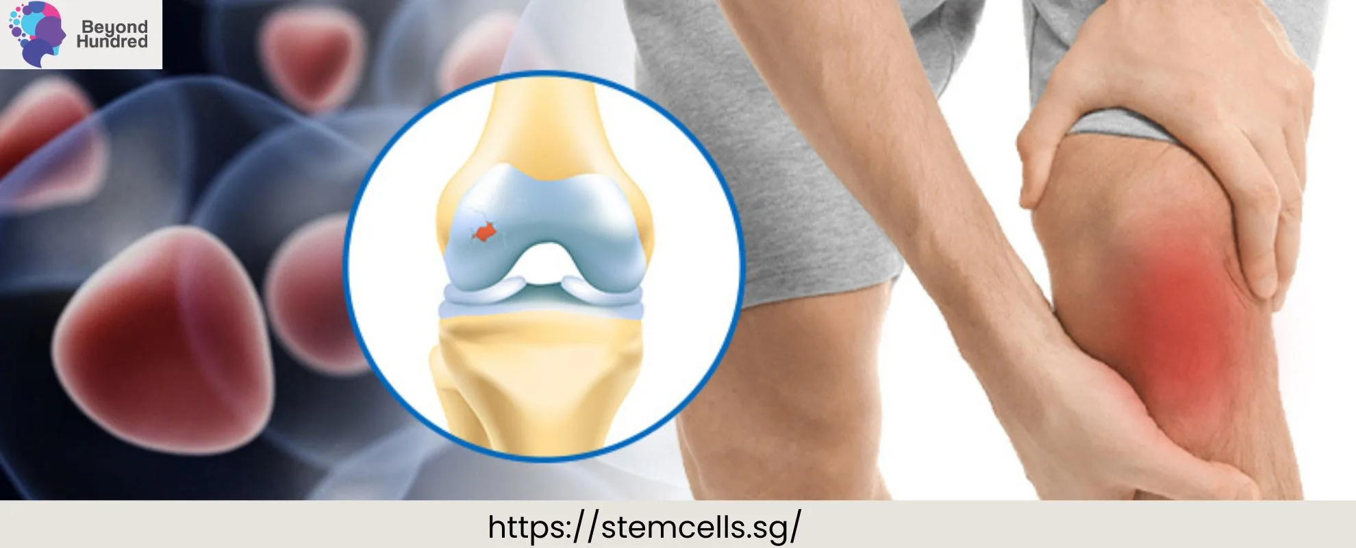 Stem cell therapy in Singapore