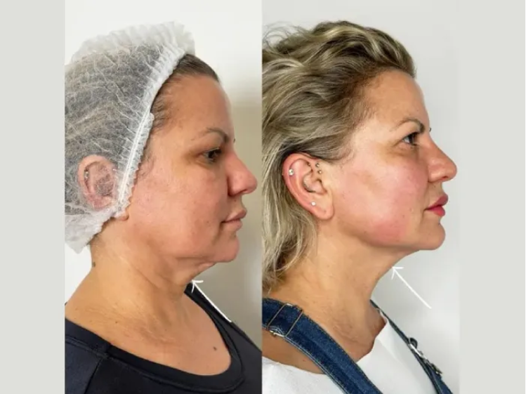 Affordable Luxury: Best Aesthetic Clinic in Dubai
