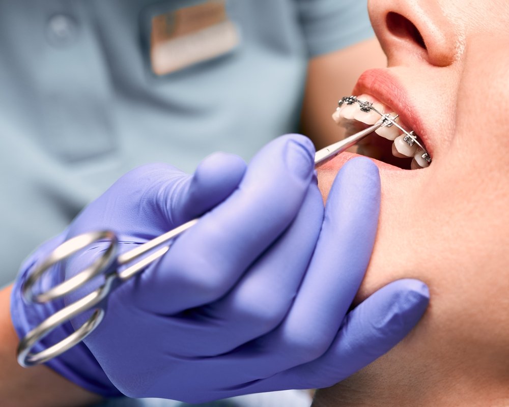 Orthodontic Dentistry in Dubai